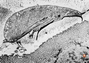Giardia (lamblia) intestinalis